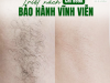 TRIỆT NÁCH CHỈ 999K BẢO HÀNH VĨNH VIỄN