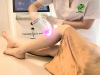 Khám Phá Top 5 Spa Triệt Lông Uy Tín Vũng Tàu