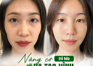 NÂNG CƠ TRẺ HOÁ VỚI HA TẠO HÌNH