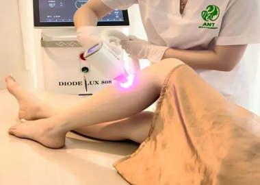 Khám Phá Top 5 Spa Triệt Lông Uy Tín Vũng Tàu