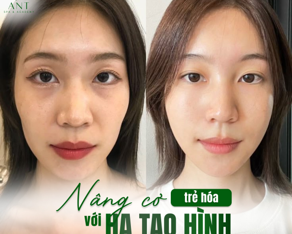 NÂNG CƠ TRẺ HOÁ VỚI HA TẠO HÌNH