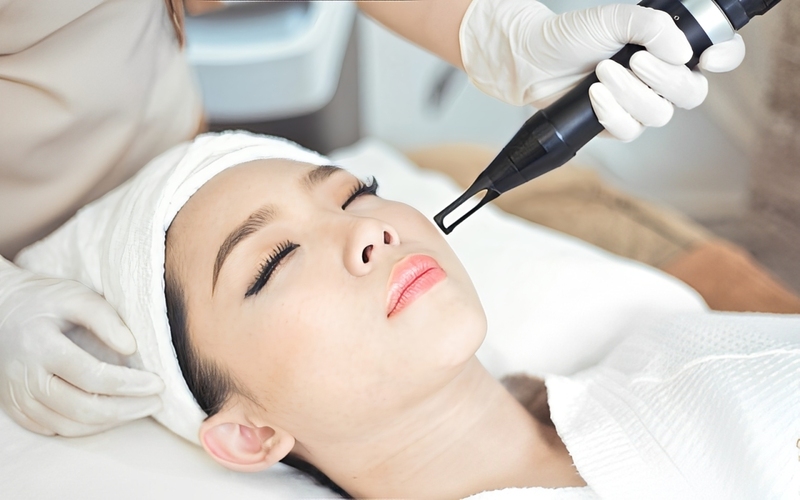 Công Nghệ Ultrayoung YAG Là Gì