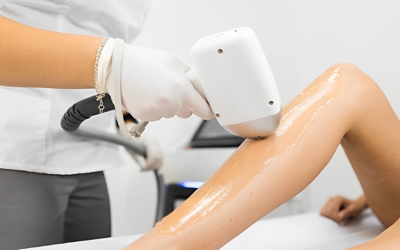 Tại Sao Nên Chọn Triệt Lông Laser Diode?