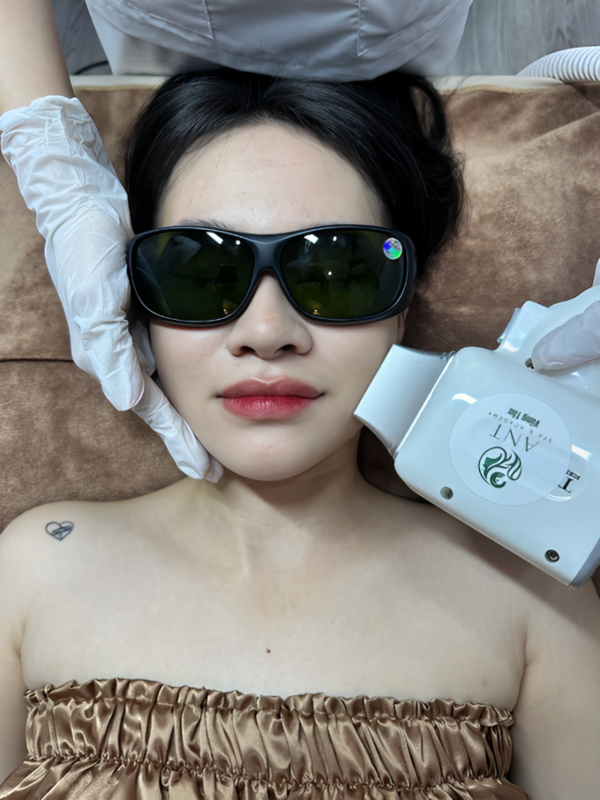 Vì Sao Nên Chọn Triệt Lông Laser Diode Toàn Mặt Thay Vì Tẩy Lông Truyền Thống